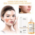 Exfoliating Glycolic Acid Liquid Lotion - B E A U T Y P R E M I U M